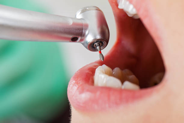 Best Pediatric Emergency Dentist in Amarillo, TX